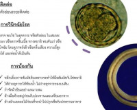 ผู้ว่าฯสุราษฎร์ธานี จับมือ นายแพทย์สาธารณสุข แถลง พบหญิงต่าง ... พารามิเตอร์รูปภาพ 8